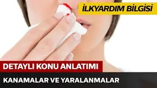 Kanamalar ve Yaralanmalar