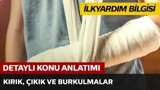 Kırık, Çıkık ve Burkulmalar