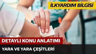 Yara ve Yara Çeşitleri
